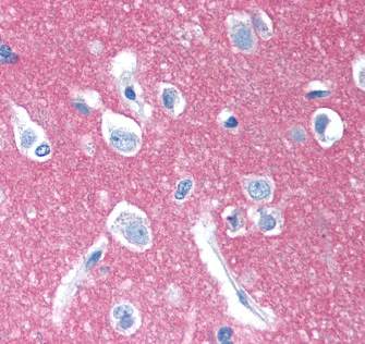Antibody CD47