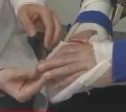 double-transplant.jpg