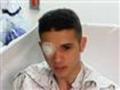 palestinians-eye-surgery.jpg