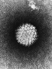 papilloma_virus-_nih.jpg