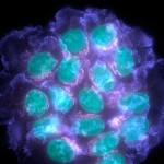 breast-cancer-cell-uc-sanfran.jpg