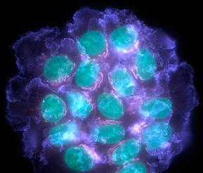 breast-cancer-cell-uc-sanfran.jpg