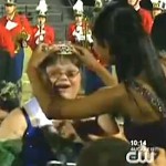 Down syndrome homecoming queen- CBS Video clip
