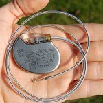 pacemaker-Steven-Fruitsmaak-GNU