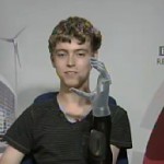 Matthew with his new bionic hand