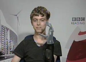 Matthew with his new bionic hand