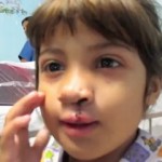 Operation Smile patient in Brazil -video screenshot