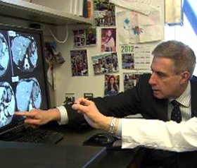 Dr. Bozell views cancer tumors -NBC video snapshot