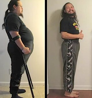 Yoga before-and-after disabled vet