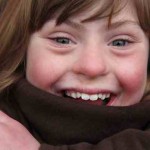 Down Syndrome girl Positive Exposures photo