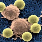 t-cells-UofPennsylvania