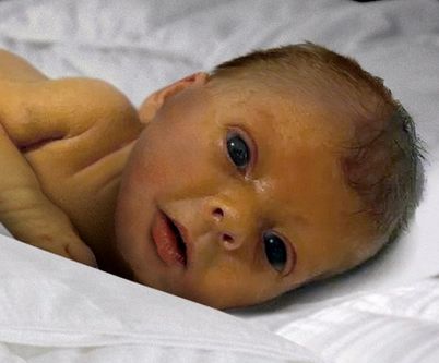 retouched-baby-photo-Imgur