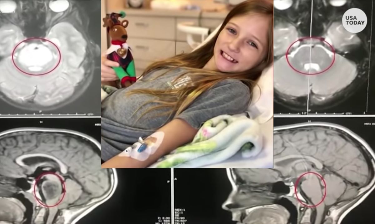 Medical miracle: Doctors baffled after Texas girl’s incurable brain tumor disappears