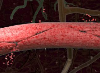 artist rendering blood vessel leaking