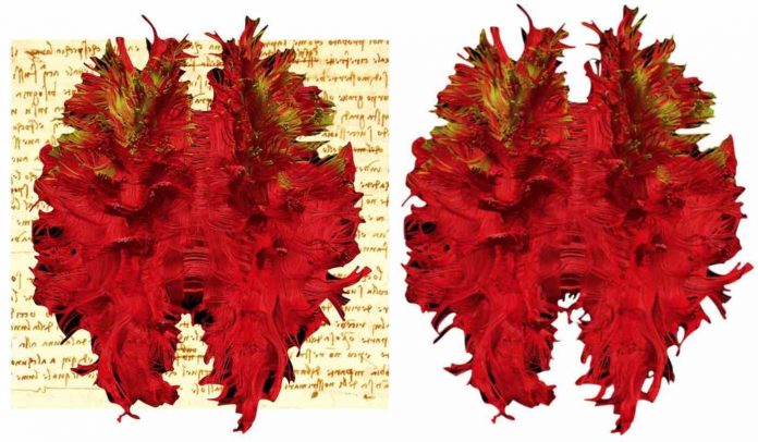 Red Paint on Page Feature-Professor Marco Catani : King's College London