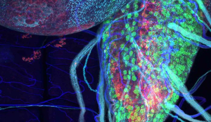 ALS-affected Nerve Cord-Zarnescu Lab Released