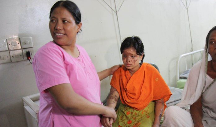 Acid Attack Survivor-CC Narayan Nath:FCO:Department for International Development