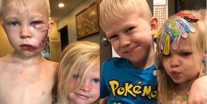 Boy saves sister-Instagram-Bridger Walker