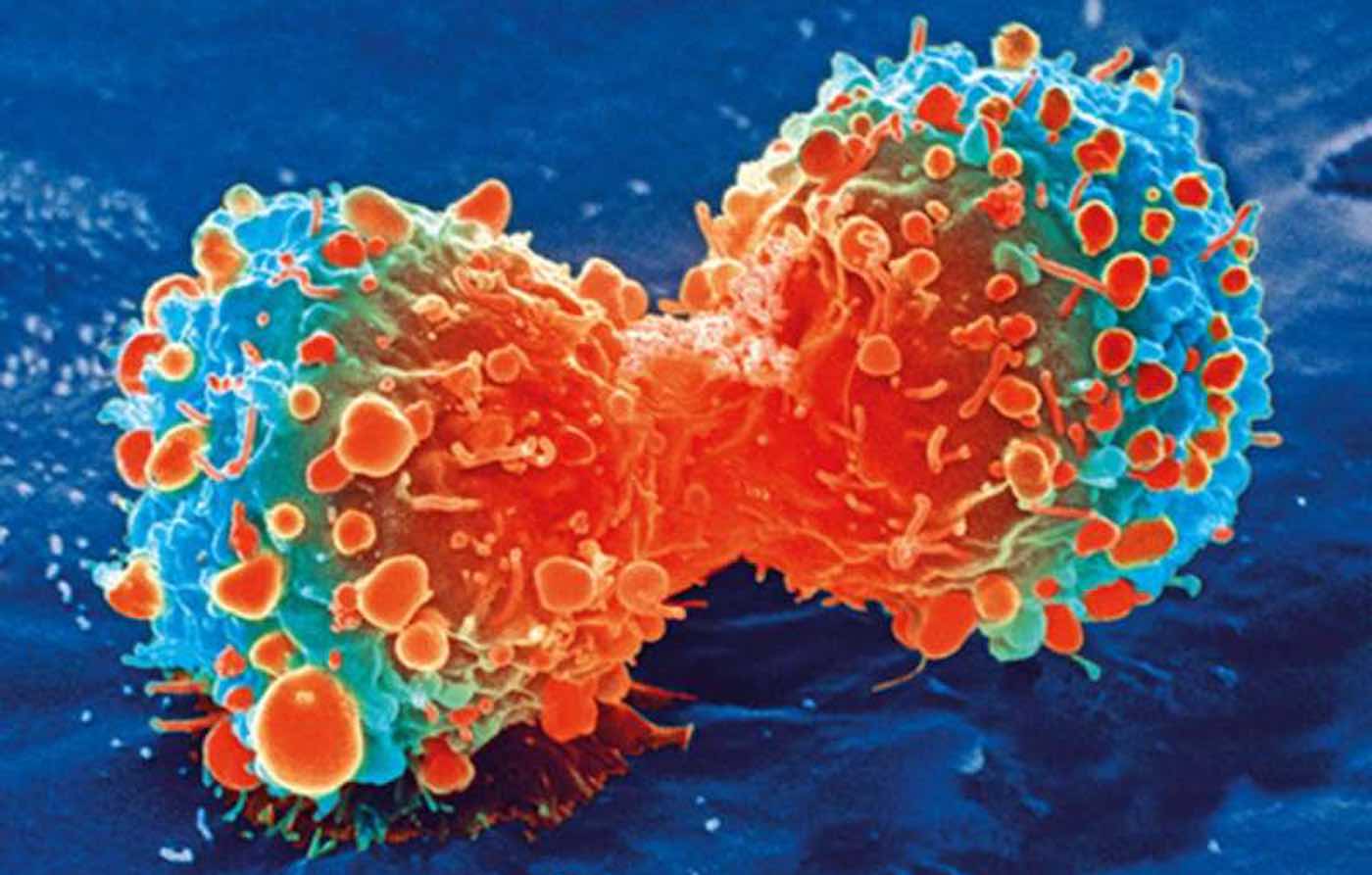 Revolutionary CRISPR-based Genome Editing System Destroys Cancer Cells 'Permanently' in Lab - Good News Network