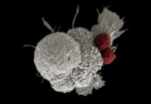 Immunotherapy Drugs So Effective that Tumors Disappear in Weeks for Head and Neck Cancer Patients in Landmark Trial