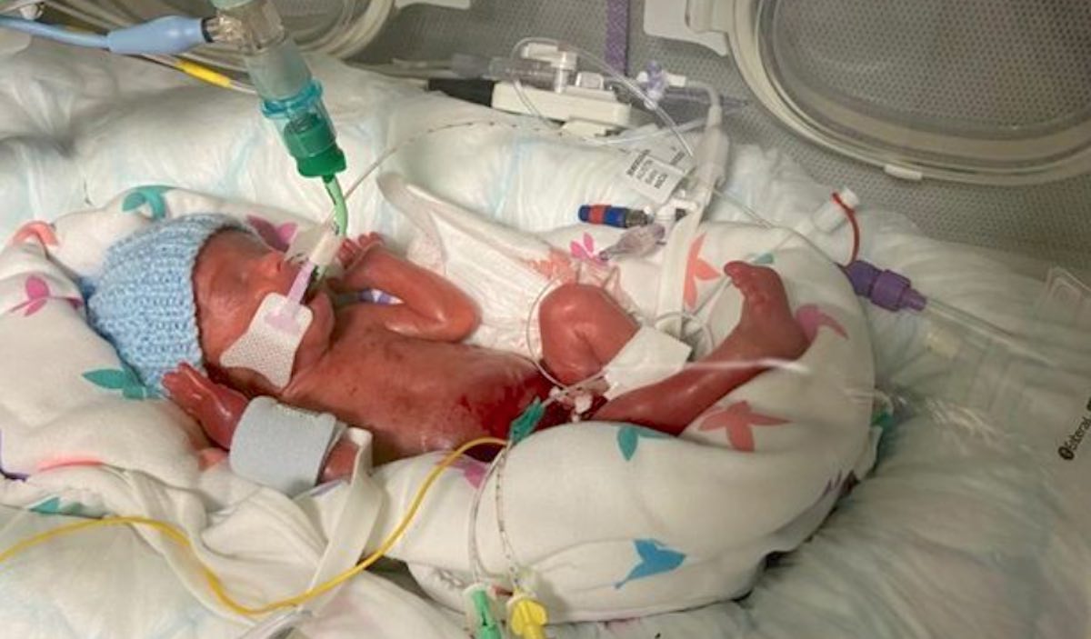 Pregnant Mom Saves Unborn Baby's Life By Rushing to Hospital