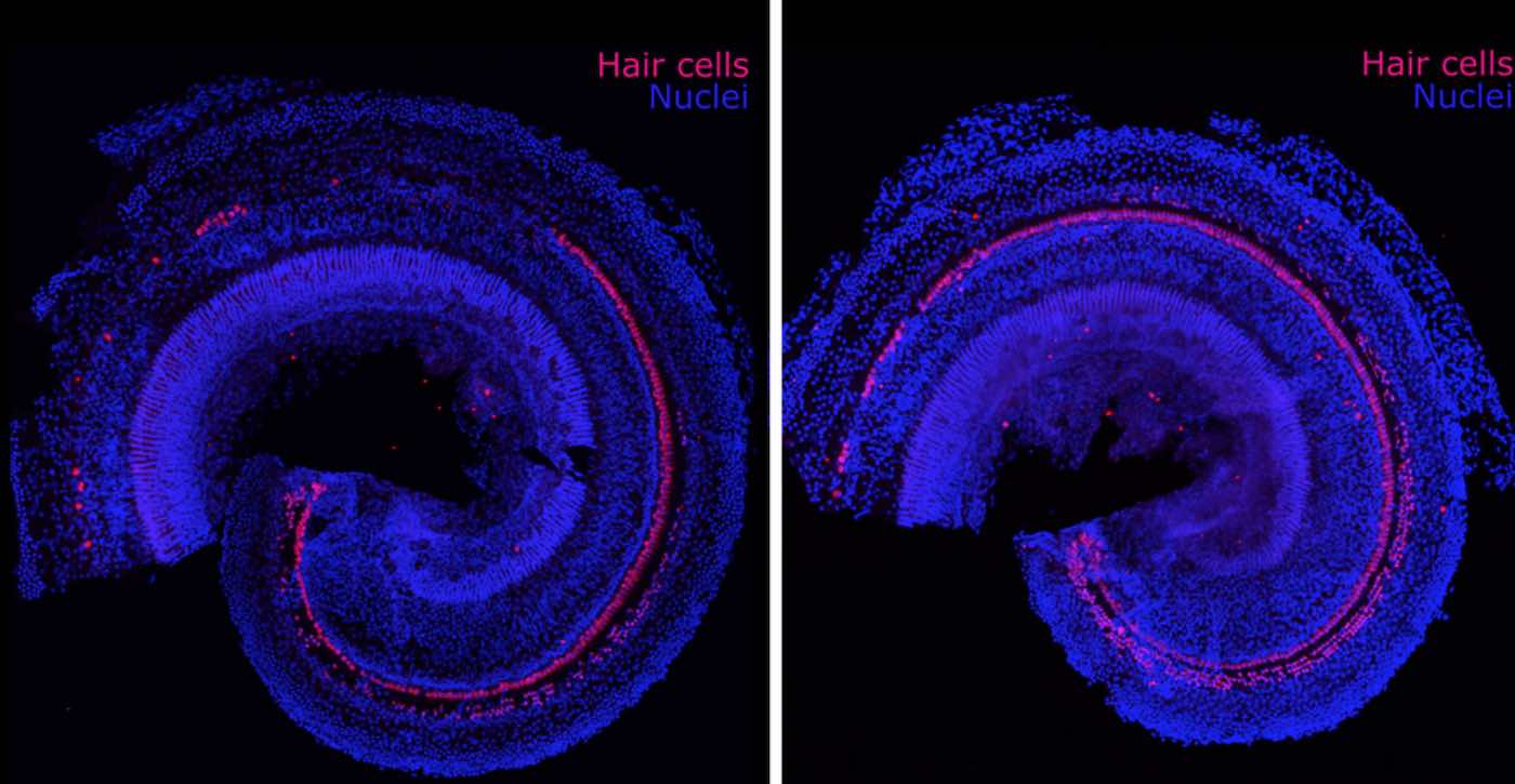 Peneliti MIT Membalikkan Gangguan Pendengaran Dengan Meregenerasi Pertumbuhan Rambut Telinga Bagian Dalam