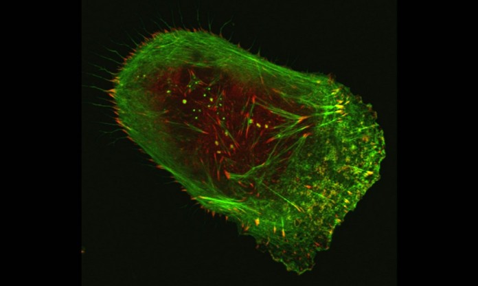 melanoma cell - Vira V. Artym, National Institute of Dental and Craniofacial Research, NIH