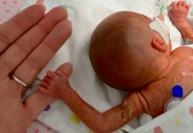 A Baby Born Weighing 1.18-lb Has Finally Come Home After Spending 4 Months in Hospital Fighting for Life (LOOK)