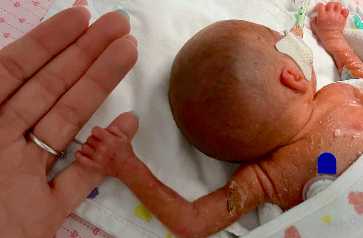 Seorang Bayi Lahir Dengan Berat 1,18-lb Akhirnya Pulang Setelah Menghabiskan 4 Bulan di Rumah Sakit Berjuang untuk Hidup (LIHAT)