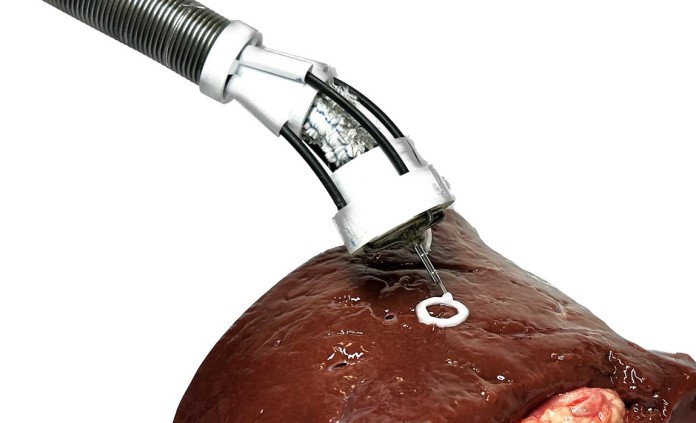 3D-printing surgical robot - SWNS