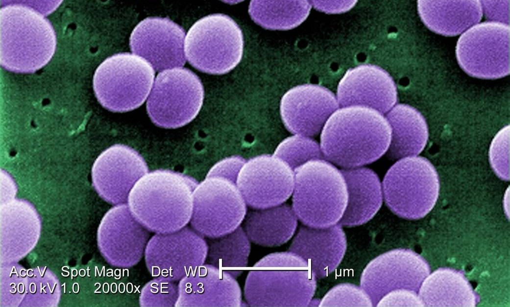 Terobosan Penyelamat Hidup untuk Antibiotik Menggunakan Kimia Pengubah Bentuk yang Memenangkan Hadiah Nobel 2022