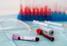 Simple Blood Test for ‘Silent Killer’ Ovarian Cancer on the Horizon After Discovery of 3 Telltale Proteins