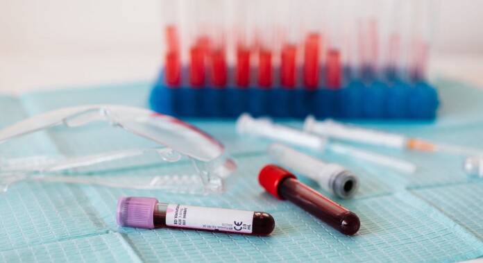 blood test vials in lab-Karolina Grabowska-pubdomain-pexels