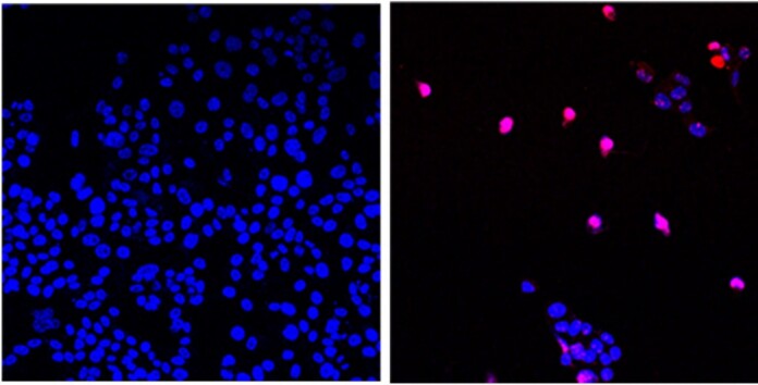 Image showing the proliferation of cancer cells before and after the new medicine - released City of Hope