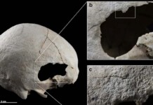 Thousands of Years Ago, a Woman Underwent Two Surgeries to Her Head–and Survived Both Procedures