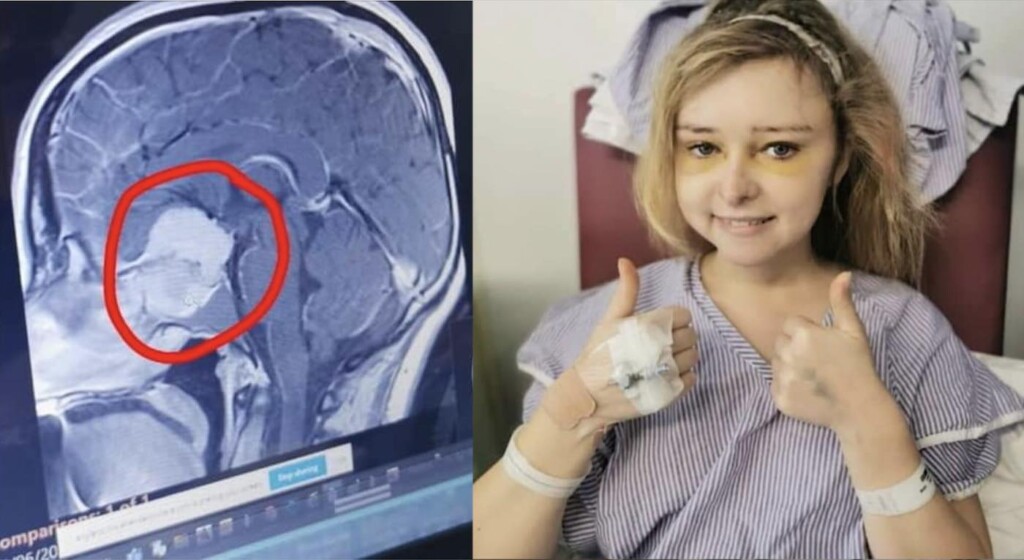 Katie Everett with Brain Scan in Basingstoke and North Hampshire Hospital Swns