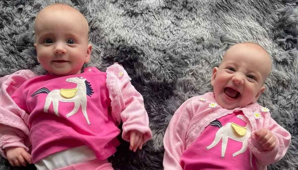 Miracle Twins Given 10 Likelihood Of Survival Are Now Thriving Due To 
