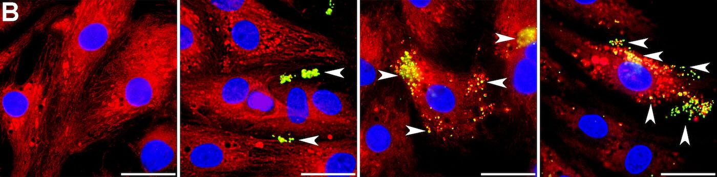 Our Mighty Mitochondria: Cell Powerhouses Can Be Harnessed for Healing