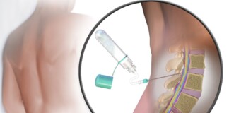 Patients Thought Untreatable with Rare Disease Dramatically Improve with Common Gene Therapy