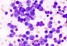 Cancer-Fighting Cells Engineered Inside Patients’ Bodies Rather Than Laboratory for the First Time