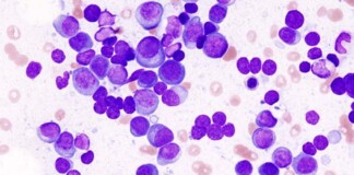 Cancer-Fighting Cells Engineered Inside Patients’ Bodies Rather Than Laboratory for the First Time