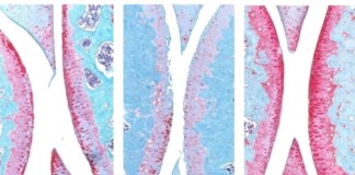 Anti-Aging Drug Regrows Knee Cartilage in Major Breakthrough That Could End Knee Replacements