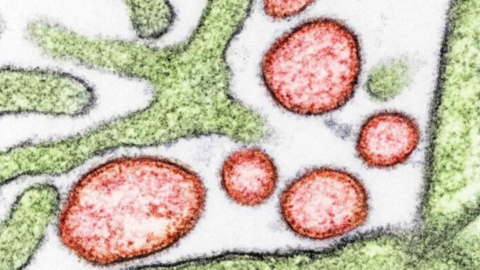 The Nipah virus pictured in red - credit, US NIH