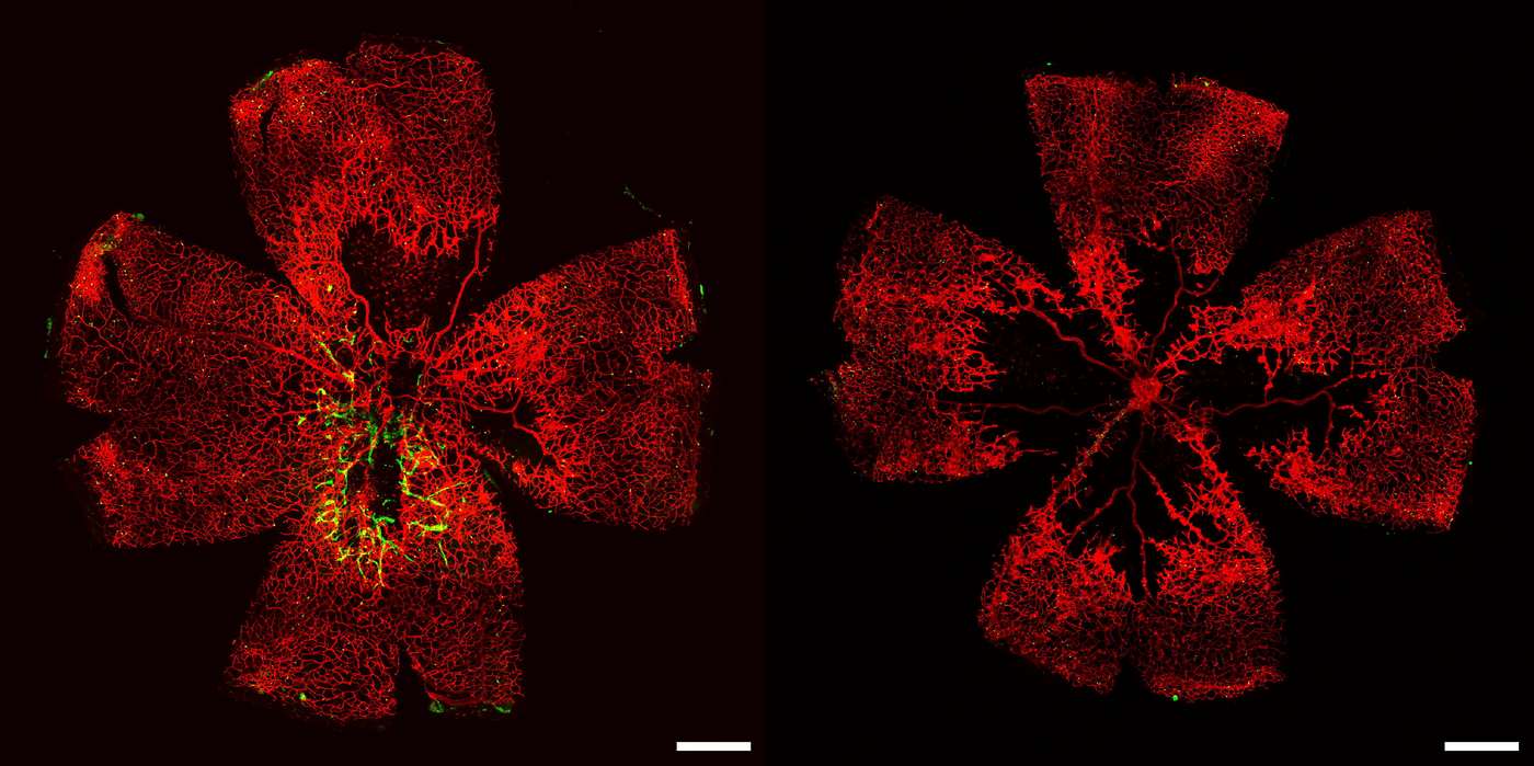 Blind People Offered Hope of Seeing Again After Stem Cell Breakthrough Remakes Retinal Blood Vessels
