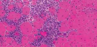 New Treatment Shows Remarkable Motor Improvements in Boys With Muscular Dystrophy—in Just 12 Weeks