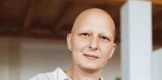 Arthritis Drug Demonstrates Substantial Hair Regrowth in 1,400 Alopecia Patients