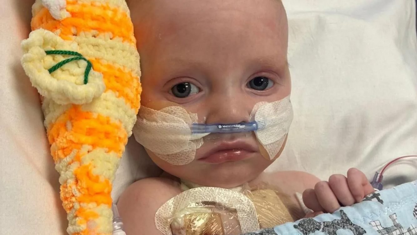 BERLIN HEART DEVICE KEEPS BABY THRIVING BEFORE TRANSPLANT